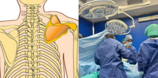 Për herë të parë ndërhyrje kirurgjikale tek fëmijë me deformim kongjenital të rrallë